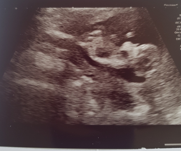Can anyone see a nub? Gender guess❤