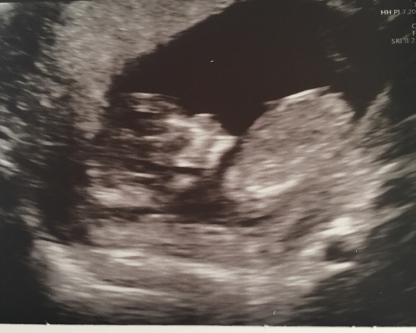Gender guesses