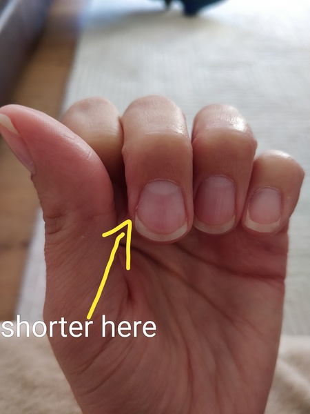 What's wrong with my nail?