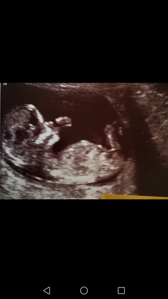 Last minute guesses! Gender scan today.. Just for fun!
