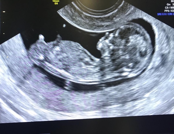 Gender guess ?