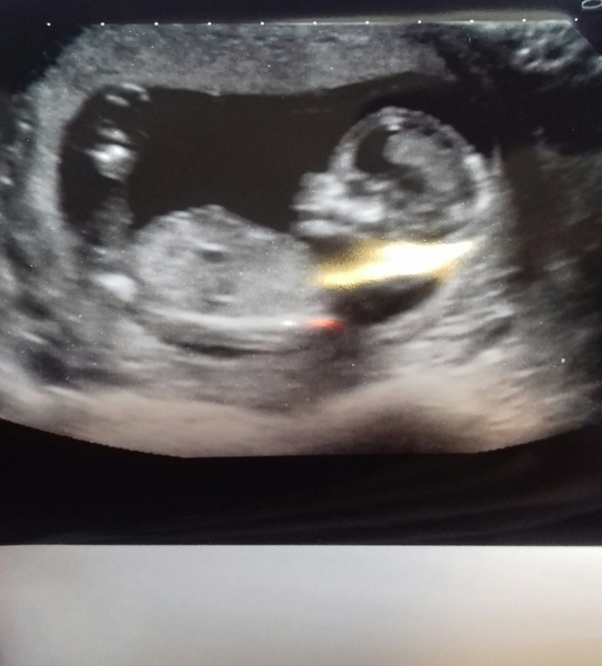 First babies due in April
