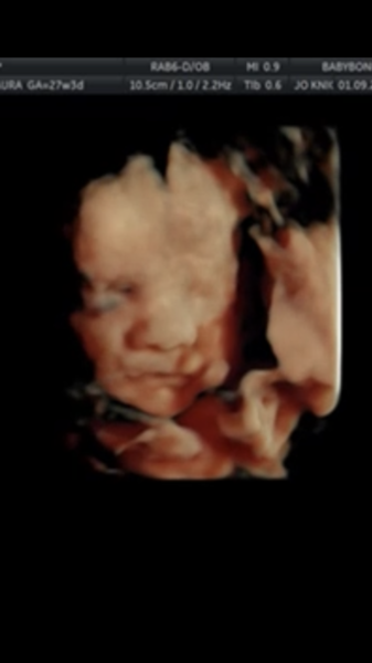 December 2018 Babies - Thread #4