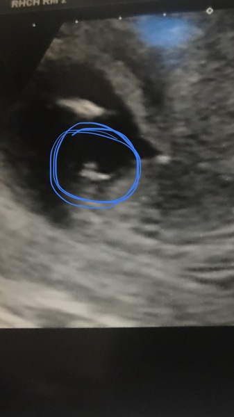 Nub theory/stacking.. Can anyone help with a sexing question?