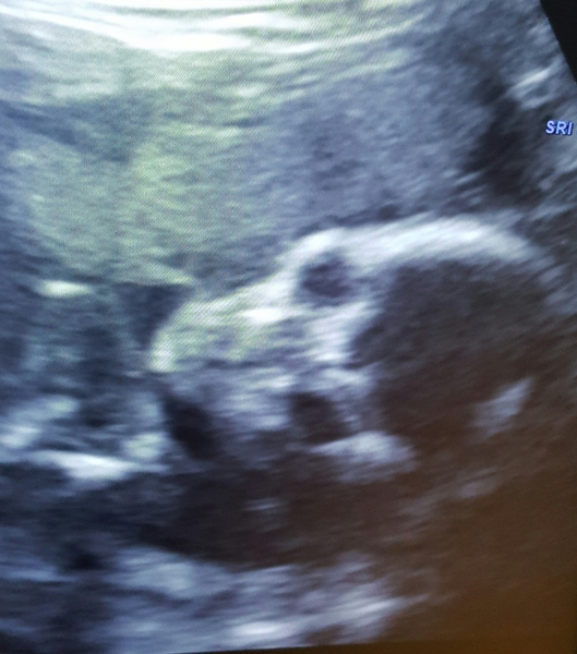 2d scan of face