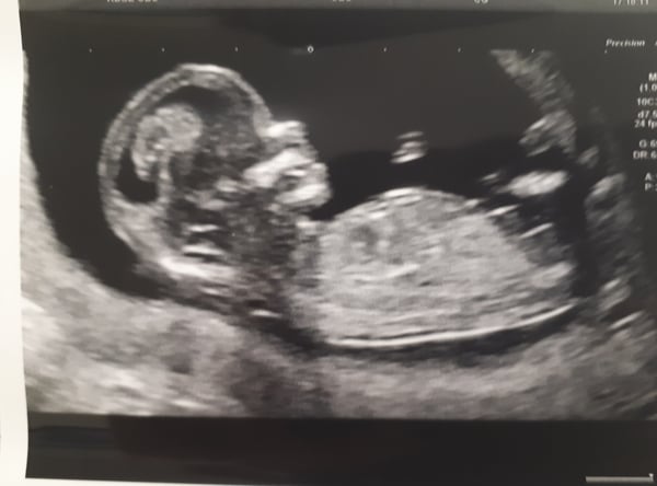 The March-ers 2019 #5