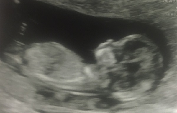 The March-ers 2019 #5