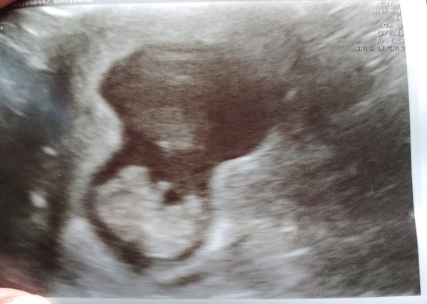 First babies due in April