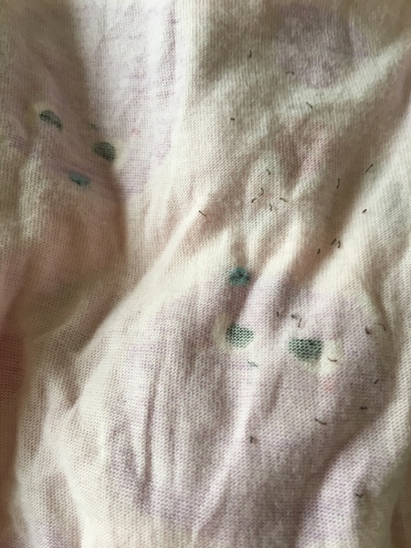 Wtaf are these disgusting catapiller worm things on my dd pyjama bottoms ?!