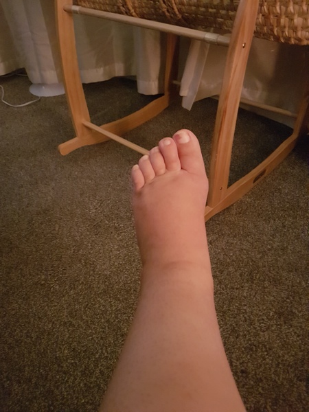 Swollen ankles and fingers... to worry?
