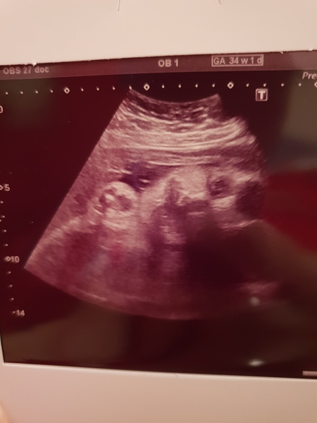 2d scan of face
