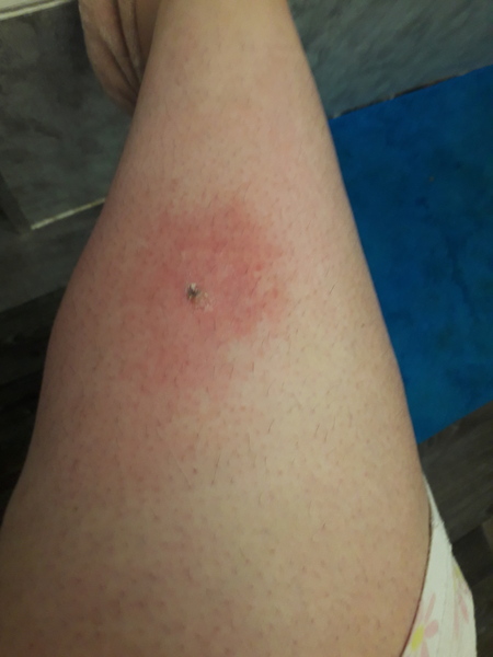 Thinking this may be infected?