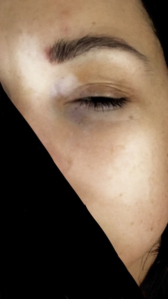 Is there any point seeing GP for vitiligo? (Pic)