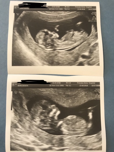 Any gender guesses?