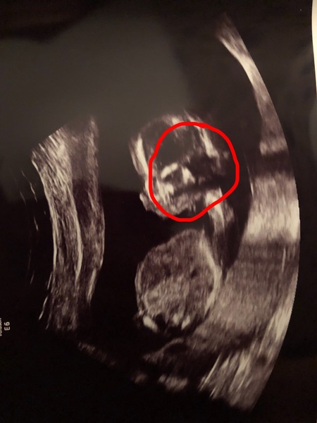 The March-ers 2019 #5