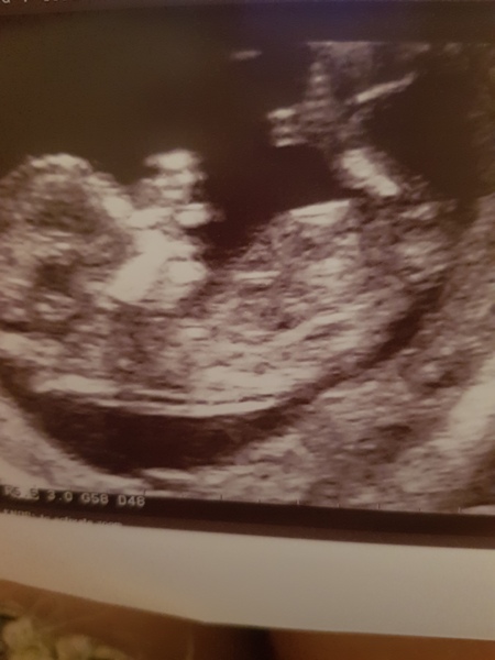 Can you guess the sex of my baby