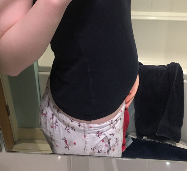 Bloat or baby?