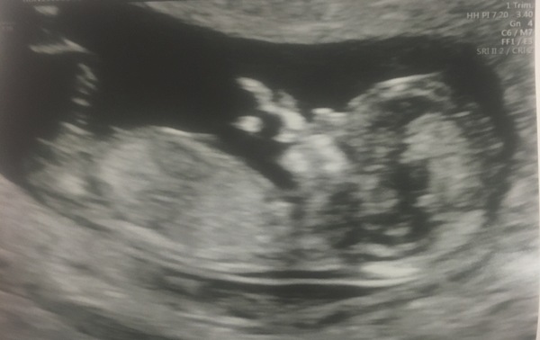 The March-ers 2019 #5