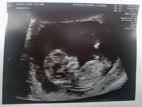 The March-ers 2019 #5