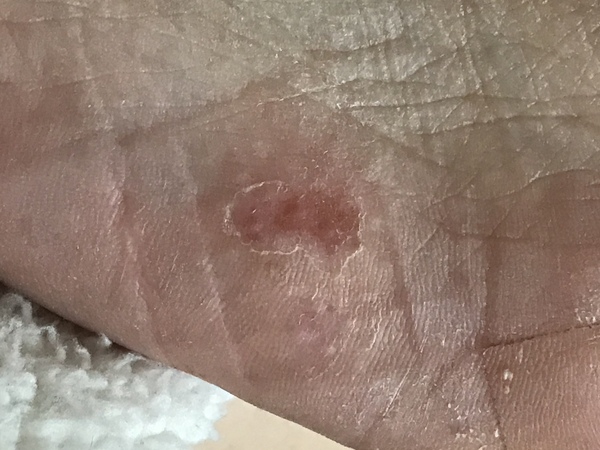 What’s wrong with my foot / feet