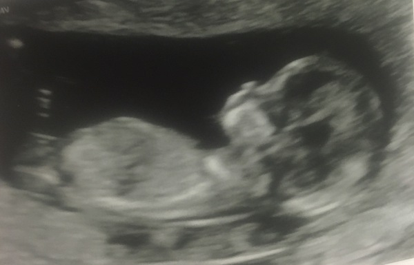 The March-ers 2019 #5