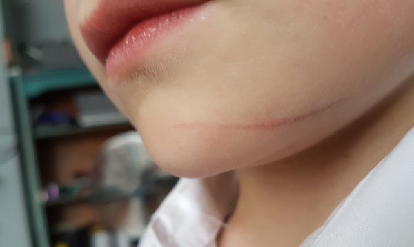 DS was 'stabbed in the face' at school