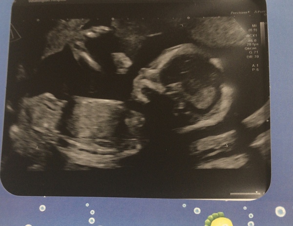 Due Feb 2019 - we’re halfway!