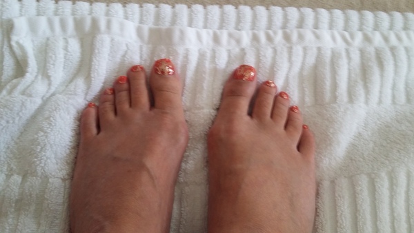 Is this bunions ? (Pic)