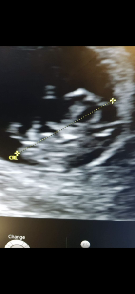 First babies due in April