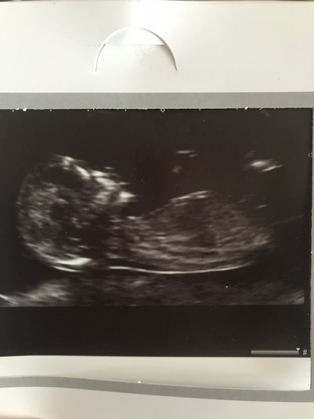 Gender Guesses 💙💖