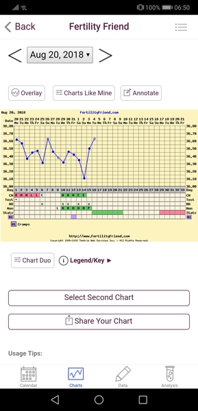 Any one had this?