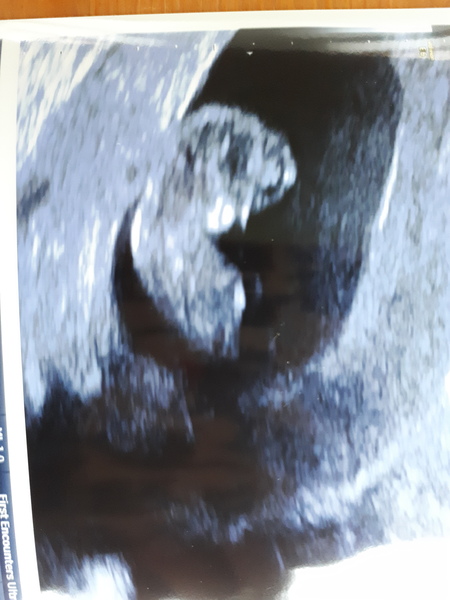 10 week private scan