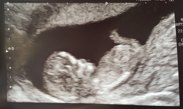 The March-ers 2019 #5