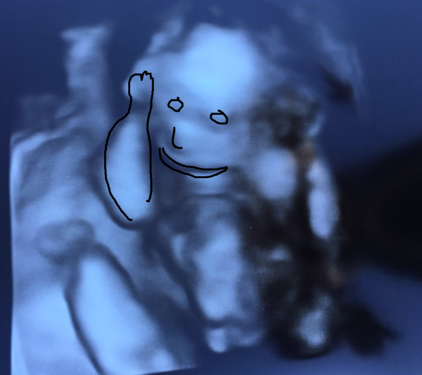 Anyone else have a weird looking 3D scan?