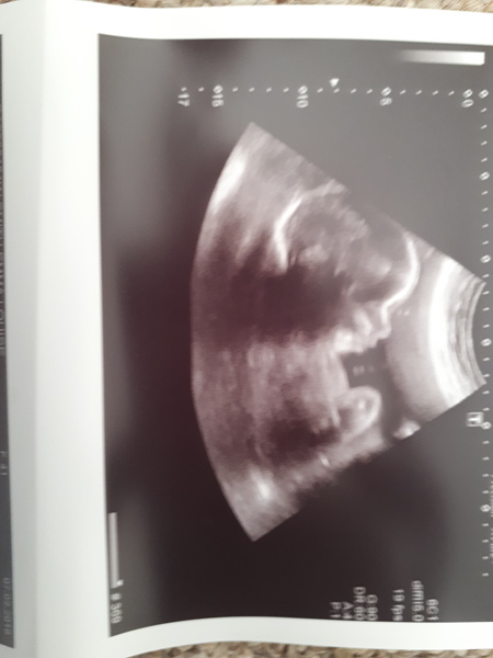 December 2018 Babies - Thread #4