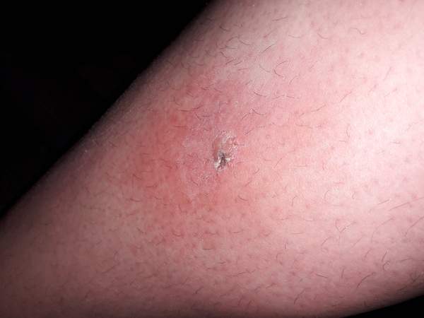 Thinking this may be infected?