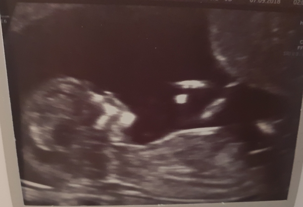 The March-ers 2019 #5