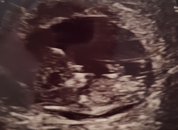 April 2019 babies continued