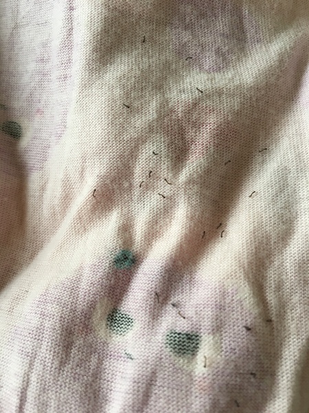 Wtaf are these disgusting catapiller worm things on my dd pyjama bottoms ?!
