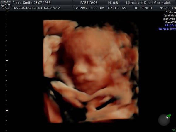 December 2018 Babies - Thread #4