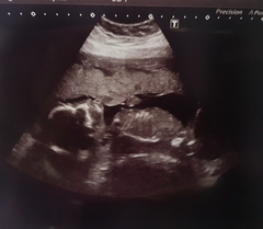Feb 2019 babies thread 7! Growing bumps and gender reveals!