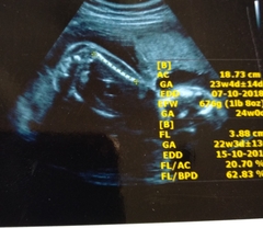 here is my 22 weeks 3 days twins scan.Please guess the gender from scan