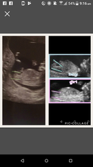 The March-ers 2019 #4