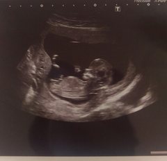 The March-ers 2019 #4