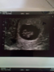 More Christmas Cake! Pregnancy after loss (thread 3)