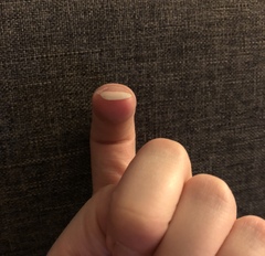 What's wrong with my nail?