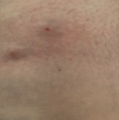 What the F bit me!?!?