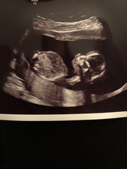 The March-ers 2019 #5