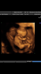 Pregnancy after loss: spring 2019 edition (The Brexit Babes) 🐧