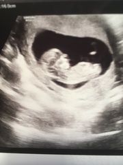 12 week scan - sex guesses